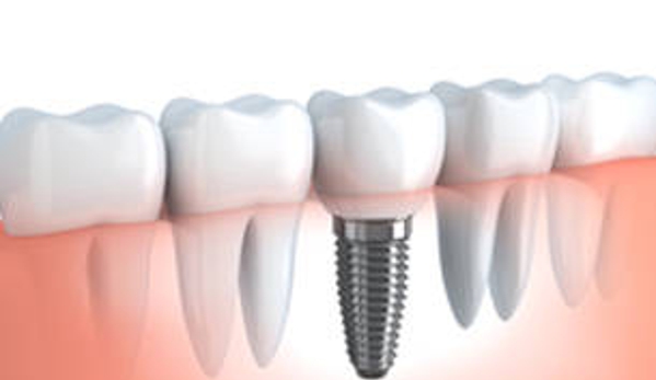 Jones Dental - Unanderra, NSW