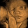 Hey Baby Ultra Sound gallery