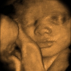 Hey Baby Ultra Sound