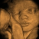 Hey Baby Ultra Sound