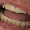 Affordable Dentures gallery