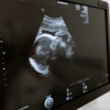 Advanced Ultrasound Care gallery