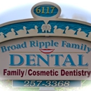Broad Ripple Family Dental - Implant Dentistry