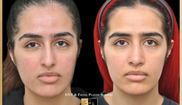 Ednan Mushtaq, MD Facial Surgery & Aesthetics - McLean, VA