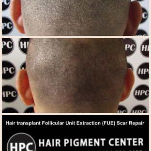 Hair Pigment Center - Hollywood, FL