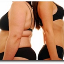 Apex Weight Loss MD - Weight Control Services