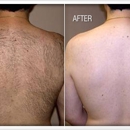 Laser Envy Medspa - Hair Removal