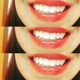 Radiant White Smiles of Austin Cosmetic Teeth Whitening