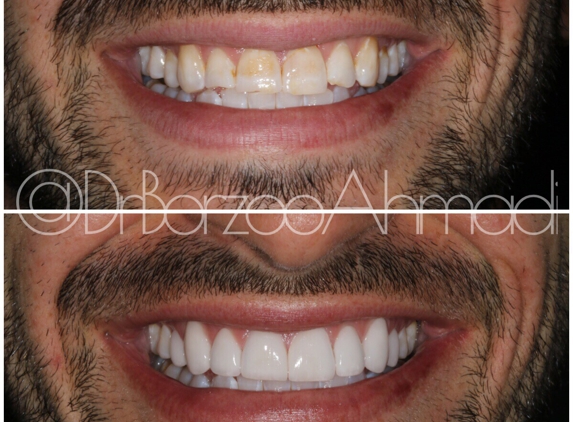 Dr. Borzoo Ahmadi DDS - West Hollywood, CA