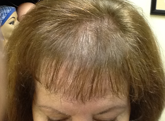 Becky Hair Replacement Specialist - Port Richey, FL