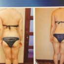 West Hills Cavi-Lipo Center - Reducing & Weight Control