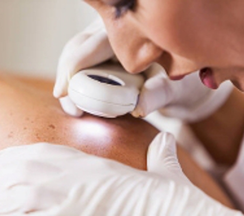 Advanced Dermatology & Skin Cancer Specialists of Moreno Valley - Riverside, CA