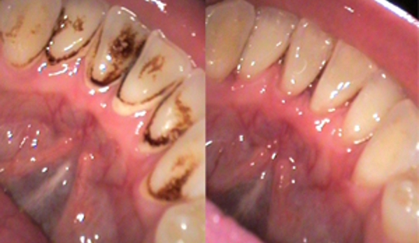 Brian Bullock Dental - Brisbane, QLD