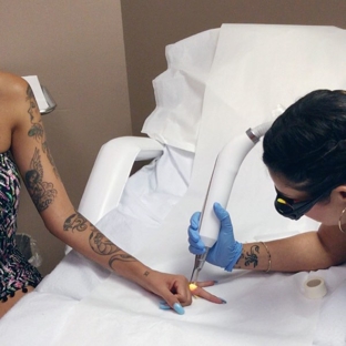 Luminosa Medical Spa - Phoenix, AZ. Tattoo Removal!