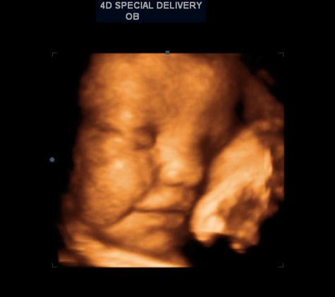 3D 4D Ultrasound by 4D Special Delivery - Upland, CA