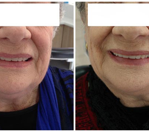 Smile Care Dentists - Geelong, VIC
