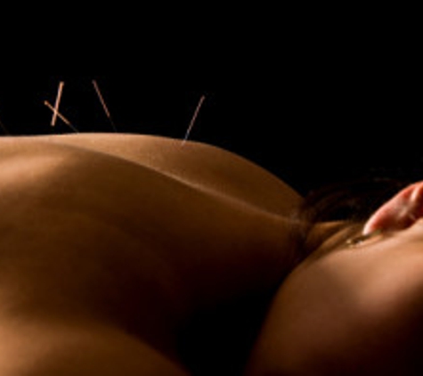 Southside Chiropractic & Acupuncture: Paul Lee DC - Saint Louis, MO