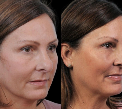 Facial Surgery Institute of Boca Raton - Boca Raton, FL