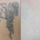 Vanish Laser Tattoo Removal and Skin Aesthetics