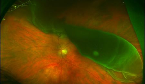 Sydney Retina - Sydney, NSW