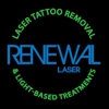 Renewal Laser Tattoo Removal gallery