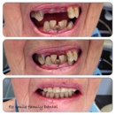 EZ Smile Family Dental Group - Implant Dentistry