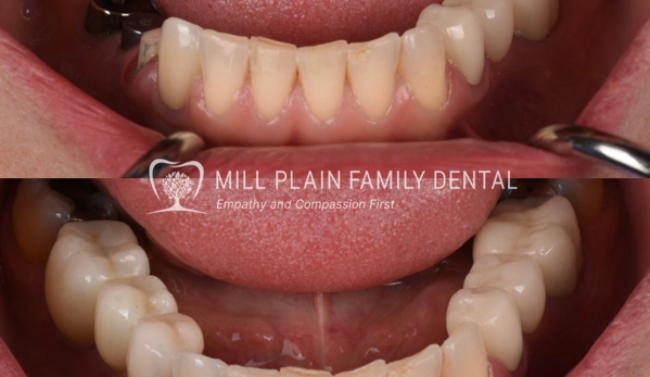 Mill Plain Family Dental - Danbury, CT