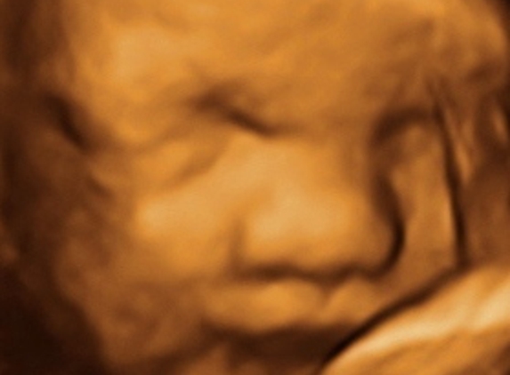 TLC Imaging 3D/4D Ultrasounds - Reynoldsburg, OH