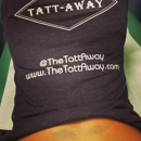 Tatt-Away of Sarasota - Tattoo Removal