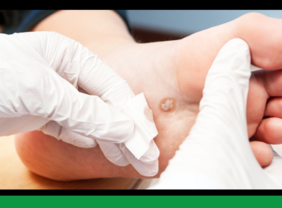 The Foot & Ankle Clinic. - Morwell, VIC. Wart Treatments