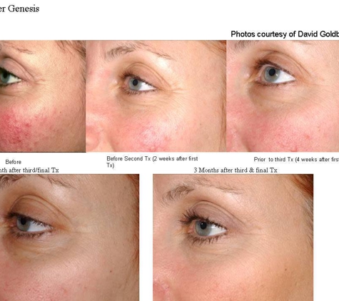 Excel Laser Skin Clinic - Weymouth, MA