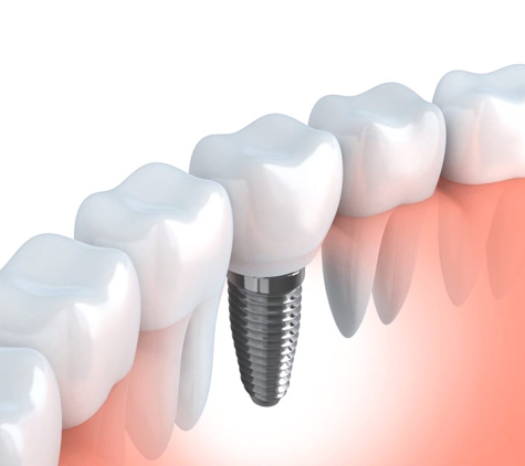 Braddon Dental Surgery
