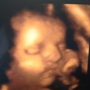Moms-To-Be Ultrasound & Pregnancy Spa