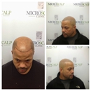 MicroScalp Clinic - Hair Replacement