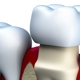 Portland Periodontics-David A. Goldwyn, DDS, PC