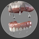 All-On-4 Dental Implants - Dentists