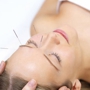 Pinebrook Acupuncture