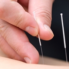 Elite Acupuncture