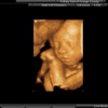 A Baby Visit 4D Ultrasound gallery
