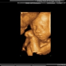 A Baby Visit 4D Ultrasound - Professional Organizations