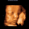 3D 4D Ultrasound by 4D Special Delivery gallery