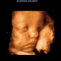 3D 4D Ultrasound by 4D Special Delivery