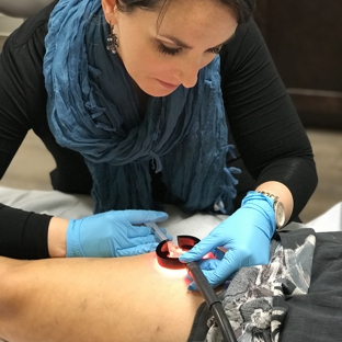 Truffles Vein Specialist - Fayetteville, GA. Aubrey Mauney NP-C performing foam sclerotherapy using the vein light.