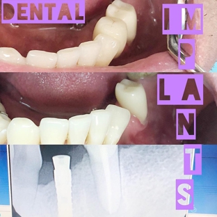 Dr Z Smiles - Aventura, FL