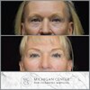 Michigan Center for Cosmetic Services - Physicians & Surgeons, Plastic & Reconstructive