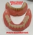 Peter Anastasia - Dental Prosthetist