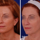 Visage Facial Plastic Surgery