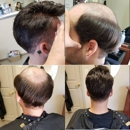 New Look Institute - Hair Replacement