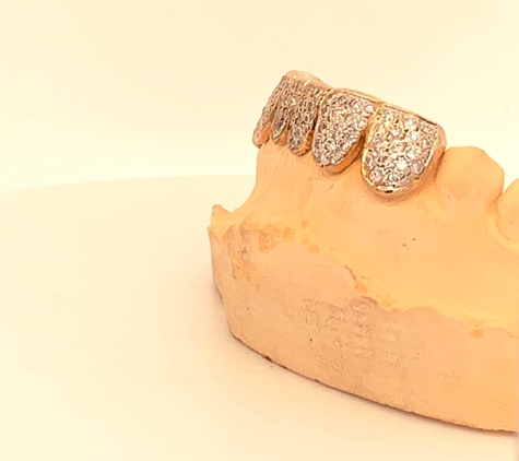 Custom Gold Grills - Seattle, WA