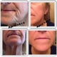 Rodan and Fields Independant Skin Consultant